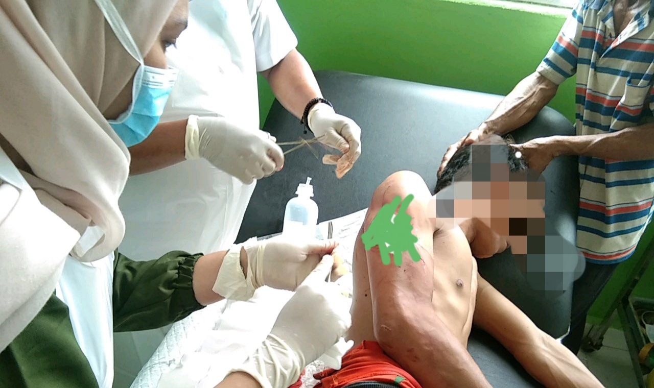 Warga Gaung Diterkam Buaya saat Jala Udang