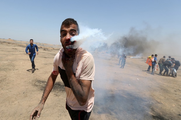 Tabung Gas Air Mata Israel Tertancap di Pipi Pria Palestina