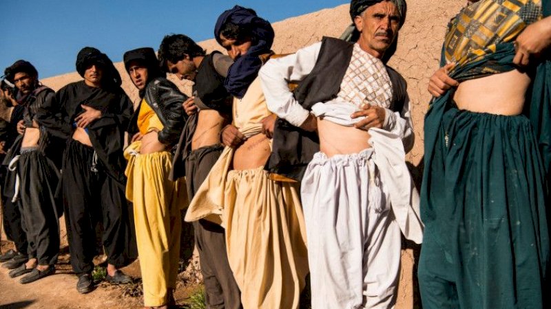 Banyak Warga Afghanistan Jual Ginjal untuk Membayar Hutang