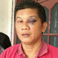 Korban Penganiayaan Desak Polda Tahan Anggota DPRD Riau Yusuf Sikumbang