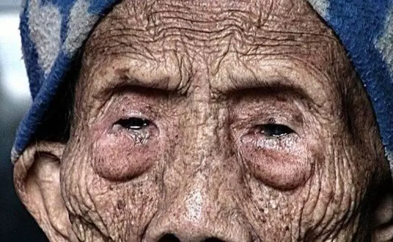 Mengejutkan, Pria Ini Berhasil Capai Usia 256 Tahun