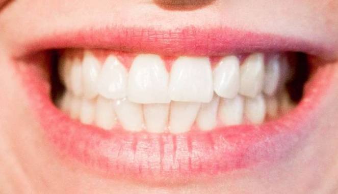 Bleaching Gigi Banyak Diminati, Amankah?