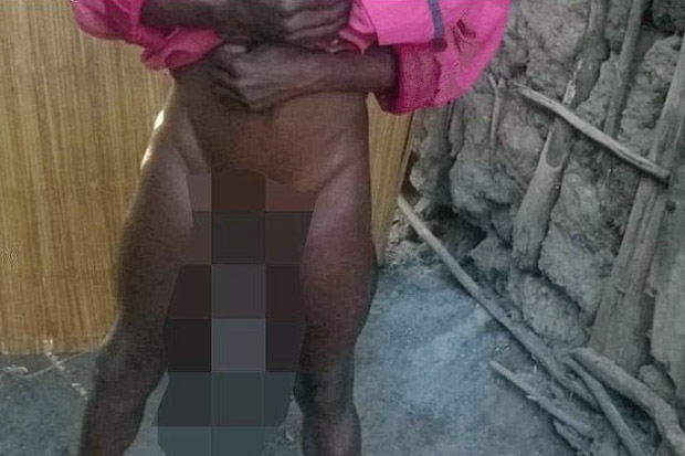 Pemuda Kenya Ini Punya Kemaluan Sebesar Bayi