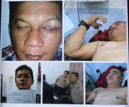 Anggota DPRD Riau Dilaporkan ke Polisi