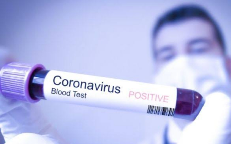 RSUD Dumai Belum Bisa Pastikan Pasien Pengidap Virus Corona