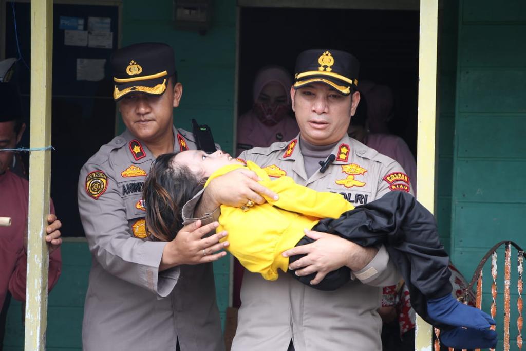 Haru dan Tangis Saat Kunjungan Kapolres Bengkalis AKBP Indra Wijatmiko ke Kediaman Anak Penderita Hidrosefalus