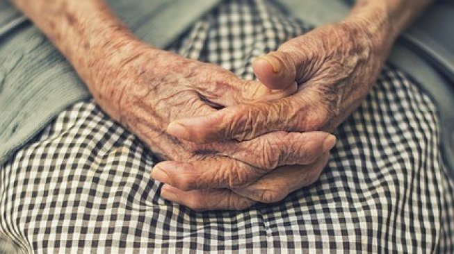 Remaja 15 Tahun Terlihat Mirip Nenek-Nenek, ini Penyebabnya