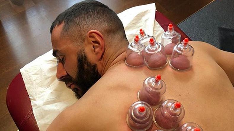 Terapi Bekam, Pengobatan Sunah Nabi untuk Usir Beragam Penyakit