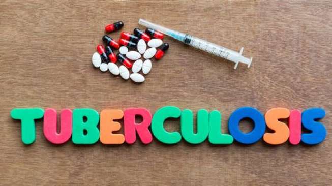 Ini yang Bikin Kasus TB Masih Tinggi di Indonesia