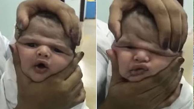 VIRAL! Perawat Lakukan Hal Mengerikan Ini pada Bayi yang Baru Lahir, Kepalanya Digencet-gencet