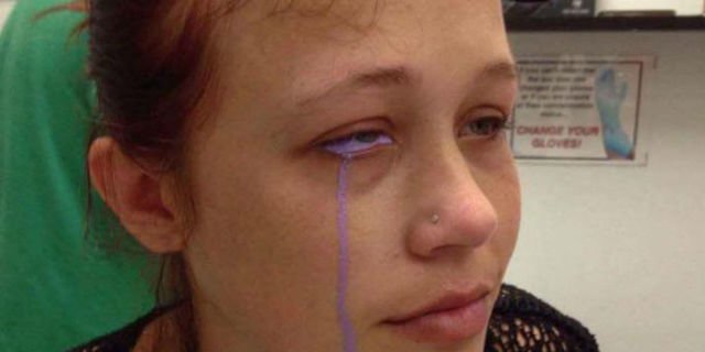 Wanita Ini Menangis Mengeluarkan Air Mata Ungu, Kok Bisa?