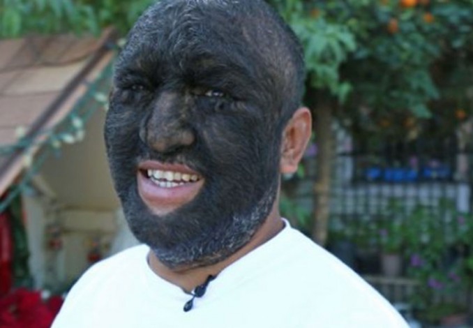 Pria Ini Dijuluki Wolf Man