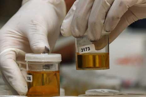 Kantor Imigrasi Tembilahan Lakukan Tes Urine