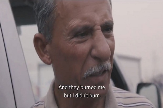 Pria Yazidi Ini Tak Mempan Dibakar Hidup-hidup 3 Kali oleh ISIS