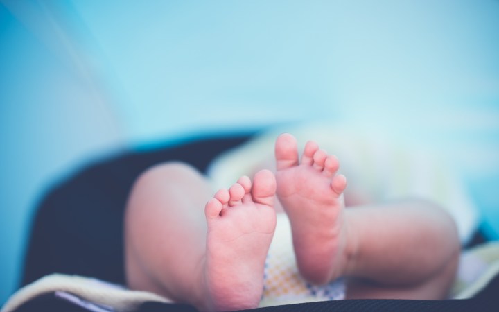 Kondisi Langka, Bayi Ini Seakan Tidak Memiliki Tengkorak dan Otak
