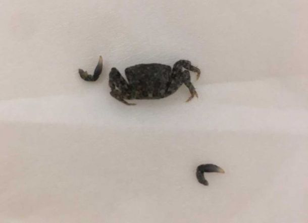 NAAS! Telinga Pria yang Sedang Asik Liburan di Pantai ini Dimasuki Kepiting