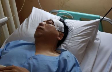 Sebelum Kecelakaan Setya Novanto Sudah DPO Duluan