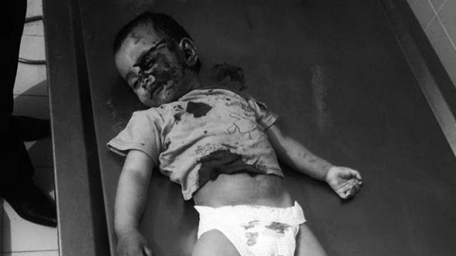 Tentara Armenia Bunuh Bayi Azerbaijan di Ganja, Foto Mayatnya Tersebar