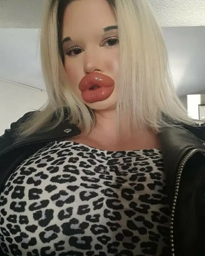 Oplas Bibir sampai Super Dower, Perempuan ini Terobsesi Mirip Boneka Barbie