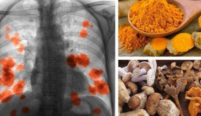 Makanan Ini Dapat Menghentikan Penyebaran Kanker Paru