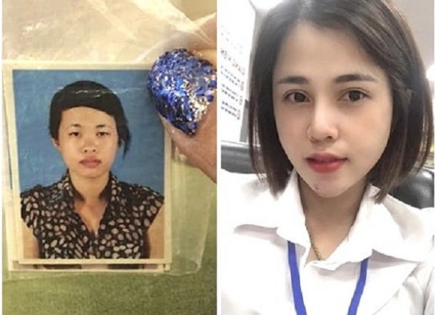 Diputuskan karena Jelek, Wanita Ini Operasi Plastik, Mantan Klepek-klepe