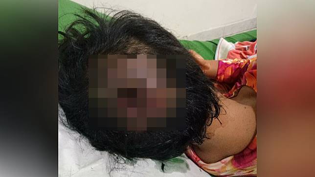KASIHAN! Kepala Bocah Ini Berlubang dan Digerogoti Ulat