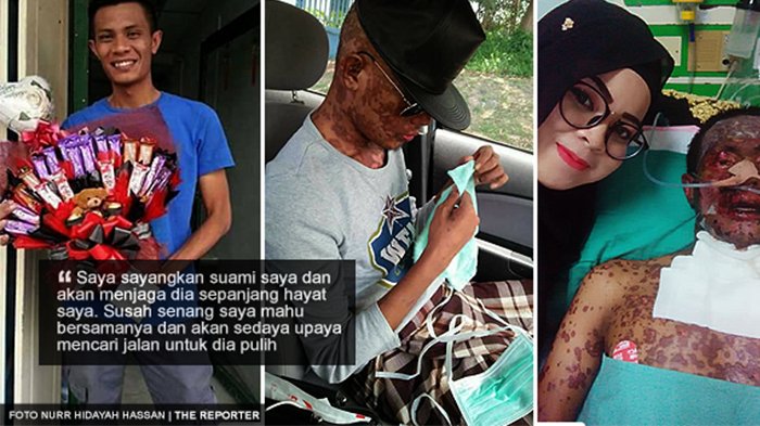 Suami Derita Penyakit Serius, Divonis Tak Bisa Sehat, Sang Istri Ungkap Hal yang Begitu Mulia