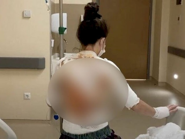 Dibangunkan untuk Sarapan Pagi, Suami Malah Siram Istri Pakai Air Mendidih