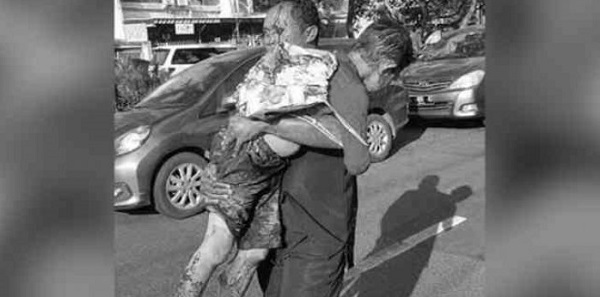 Kena Serpihan Bom, Bocah Evan Meninggal, Adiknya Masih Kritis