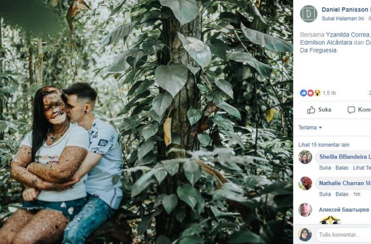 So Sweet, Kelainan Genetik Tak Buat Cinta Pria Ini Luntur