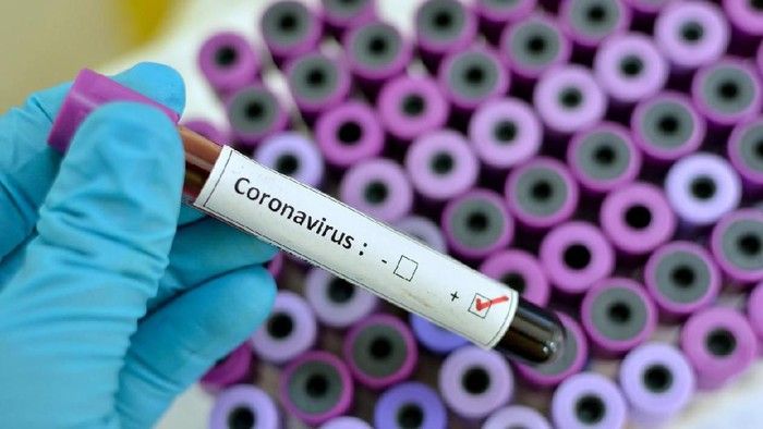 Biaya Berobat Pasien Terkonfirmasi Virus Corona Ditanggung Pemerintah