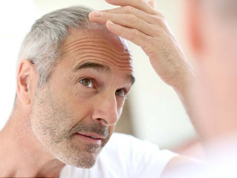 Bolehkah Mencabut Uban?