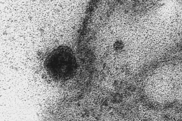 Penampakan Asli Virus Corona Saat Masuk ke Sel Tubuh Manusia