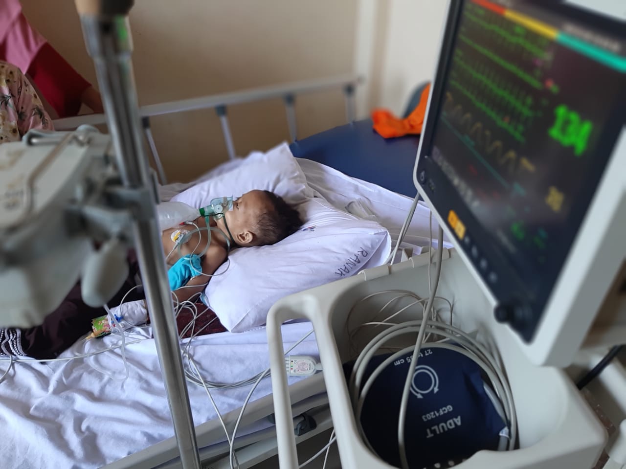 Hasbi Bayi Umur 2 Tahun Alami Leukemia Butuh Uluran Tangan