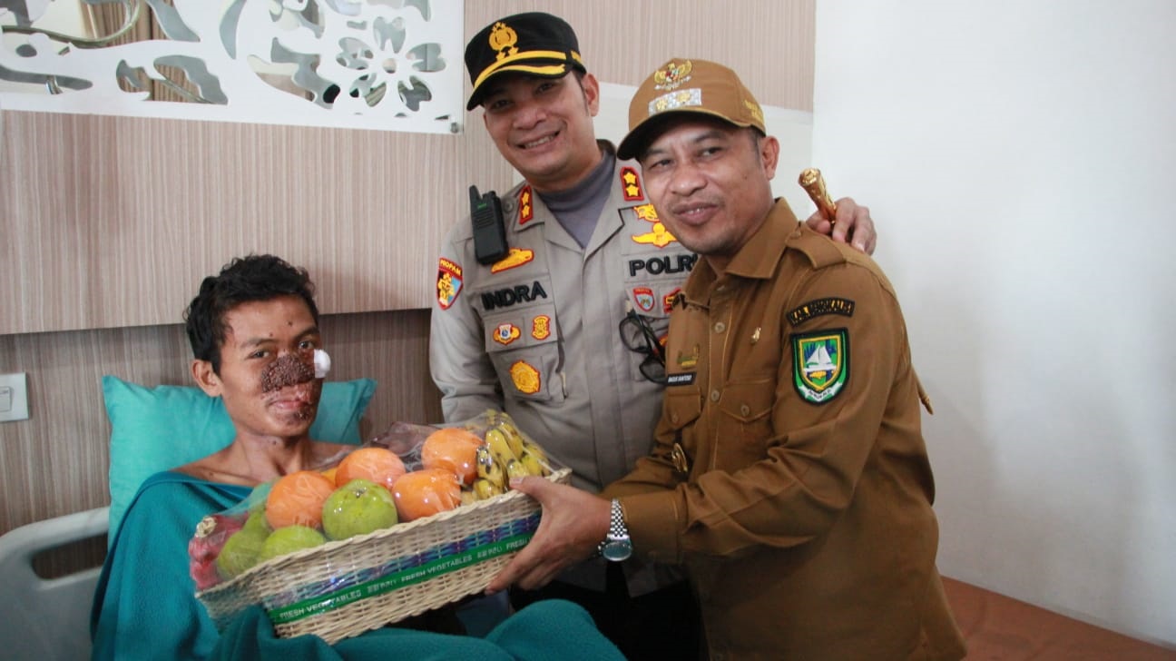AKBP Indra Wijatmiko Jenguk Pasien Penderita Tumor Wajah Bersama Wakil Bupati Bengkalis