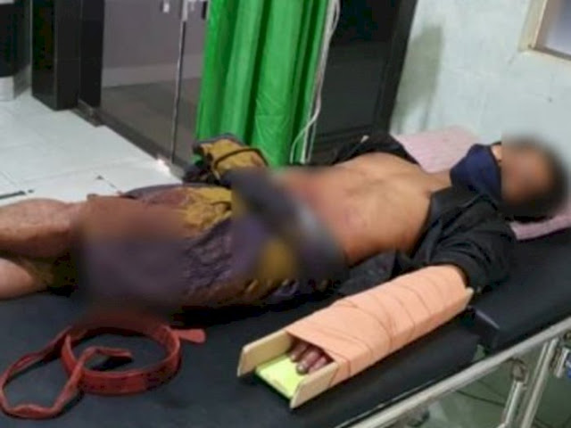Duel Ala Madura, Dua Pria Ditemukan Warga Saling Bersimbah Darah