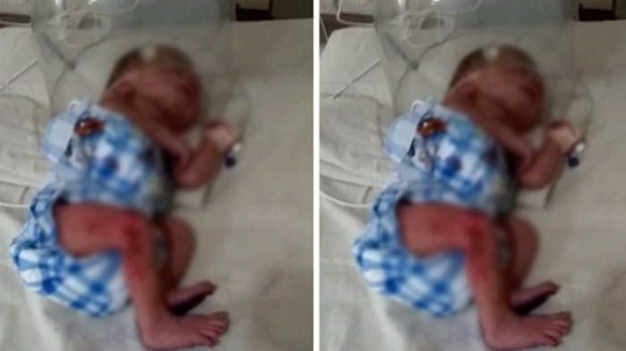 Bayi Kembar ini Dibuang Orangtuanya, Nggak Nyangka ini yang Terjadi Puluhan Tahun Berselang