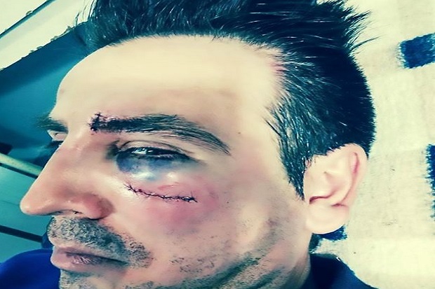 Ayah Ini Hujamkan 22 Pukulan ke Guru karena Lecehkan Putrinya