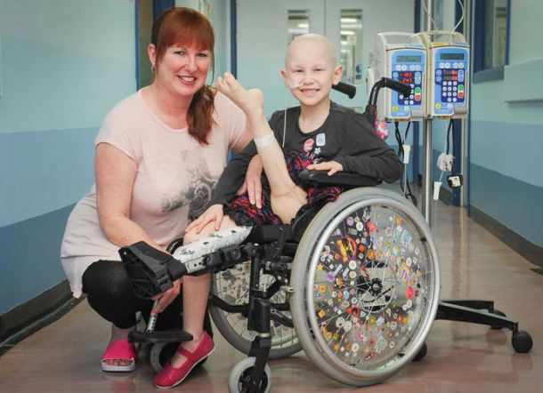 Kaki Bocah Ini yang Sengaja Dipasang Terbalik