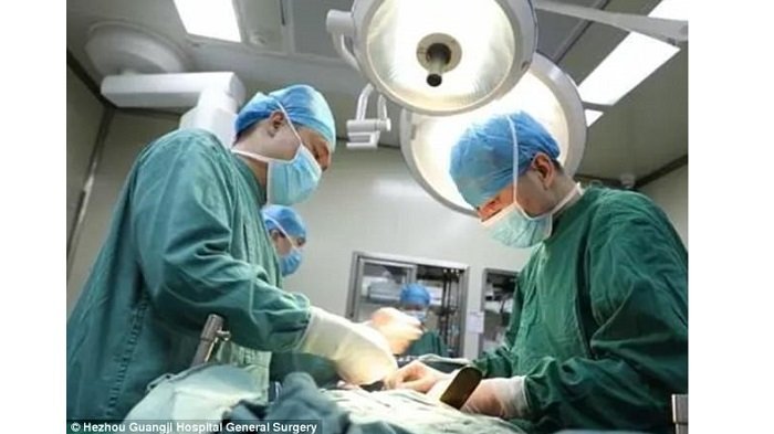 Dokter Temukan 200 Batu Ginjal di Dalam Empedu dan Hati Wanita Ini, Penyebabnya Sering Kita Lakukan!