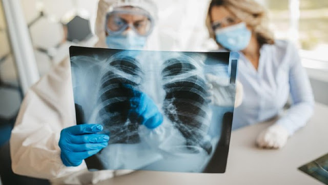 Cara Menjaga Kesehatan Paru-paru di Masa Pandemi COVID-19