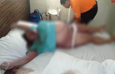 Wanita Muda yang Tewas dengan Tubuh Membengkak Itu Ternyata…