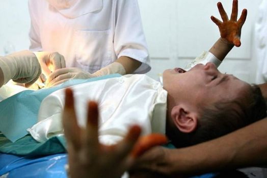 Ibu Tiri Potong Penis dan Testis Bocah 12 Tahun Pakai Pisau Buah