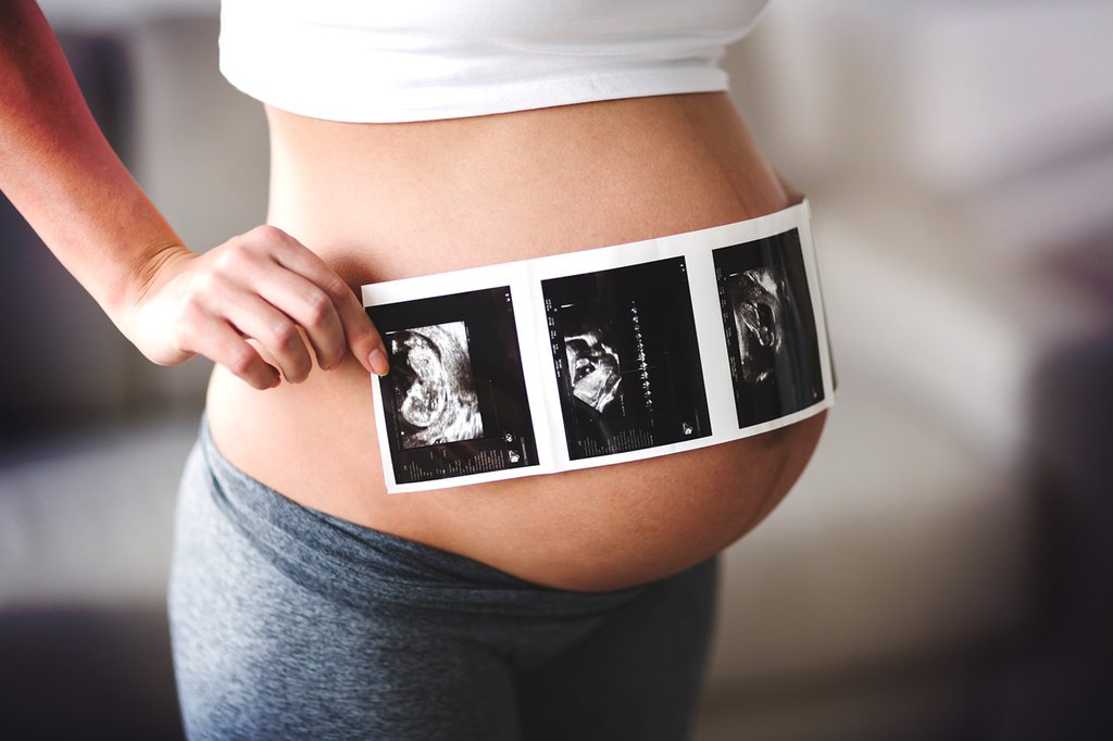 Mitos Kehamilan, dari Nanas Hingga Hubungan Seksual