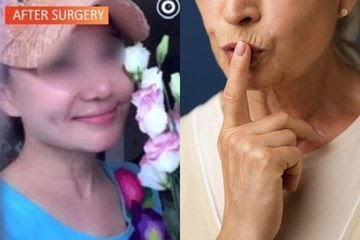 Punya Utang Rp86 Miliar, Nenek 60 Tahun Ini Nekat Operasi Plastik Jadi Gadis Cantik, Polisi Nyaris Tertipu