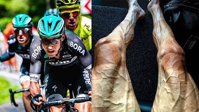 SEREM LIATNYA!!! Atlet Ini Unggah Foto Mengejutkan Efek Balapan Sepeda