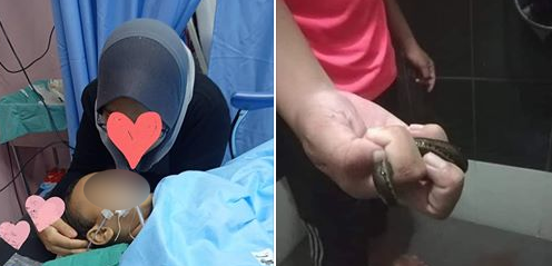 Bocah ini Muntah Darah dan Koma Setelah Bermain Air, Ternyata Lintah Bersarang Ditubuhnya