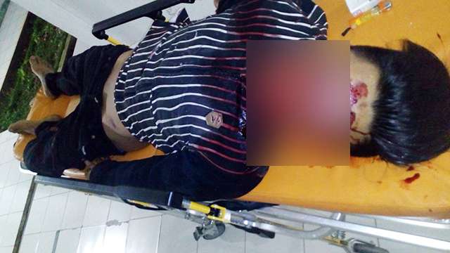 Rolas Tewas Mengerikan, Tangan patah, Kepala Remuk