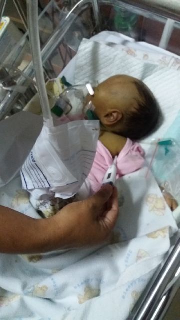 MOHON DOA, Kondis Kesehatan Rendi Bayi Usus Terburai Menurun