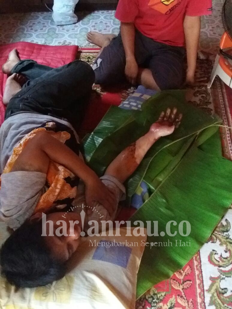 Selamatkan Rumah Batik Andalan Kuansing, Pembatik Baserah Alami Luka Bakar